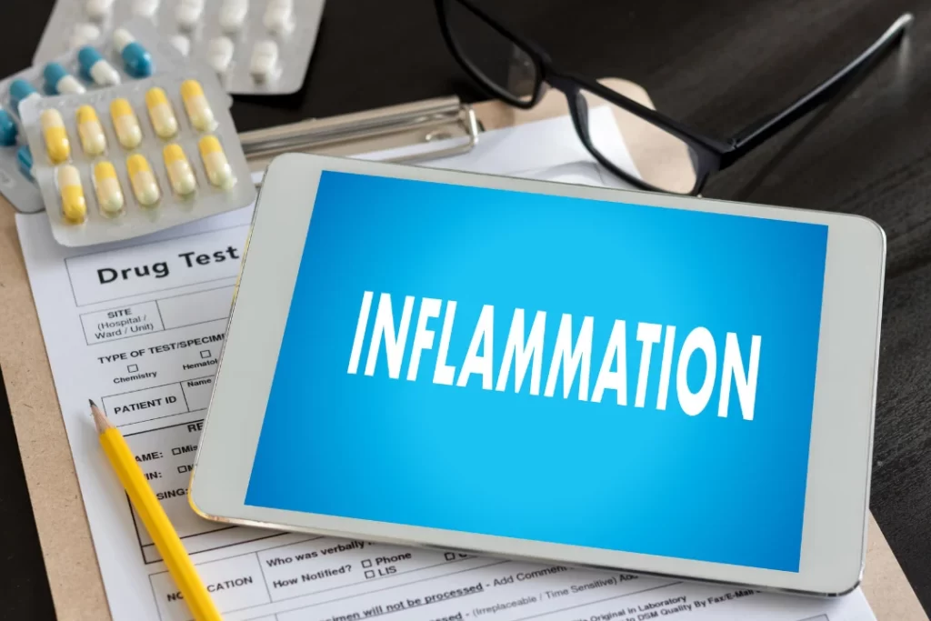 Inflammation is written on a tablet with medicine and a prescription.